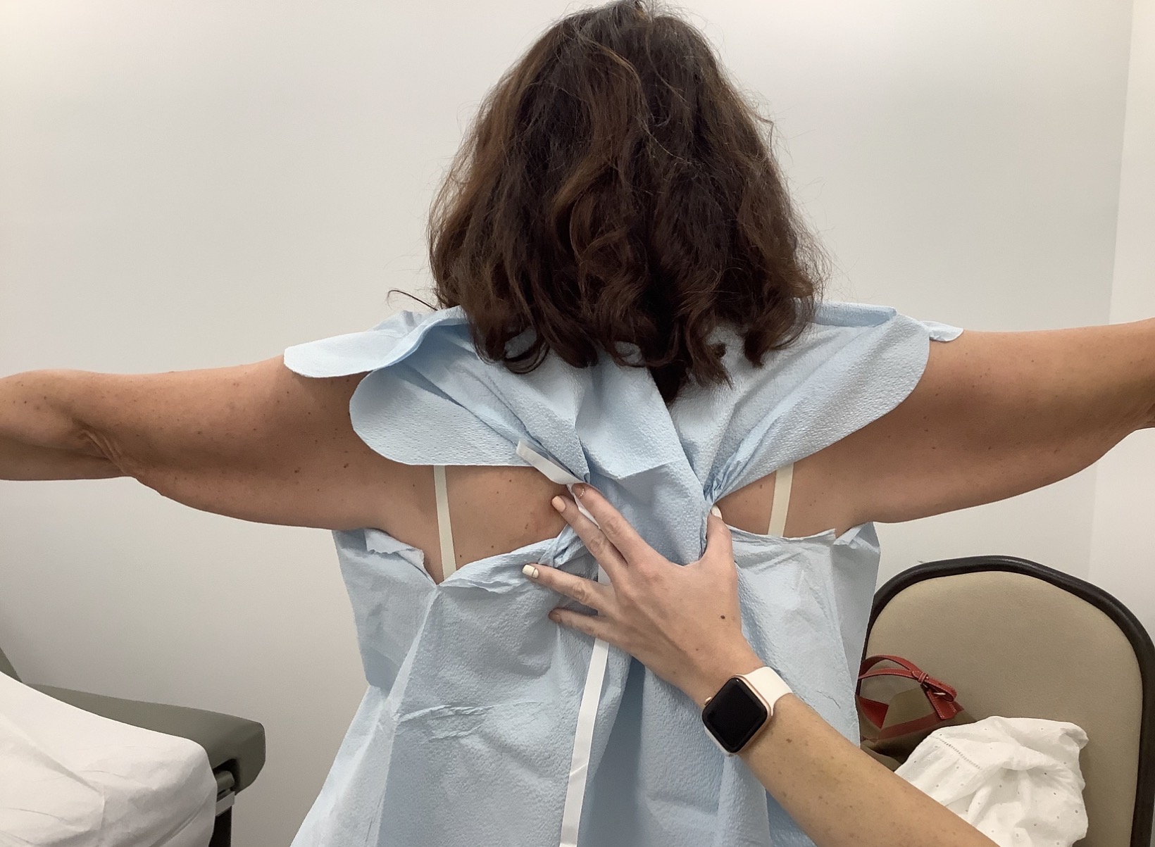 SmartLipo — before, patient 4
